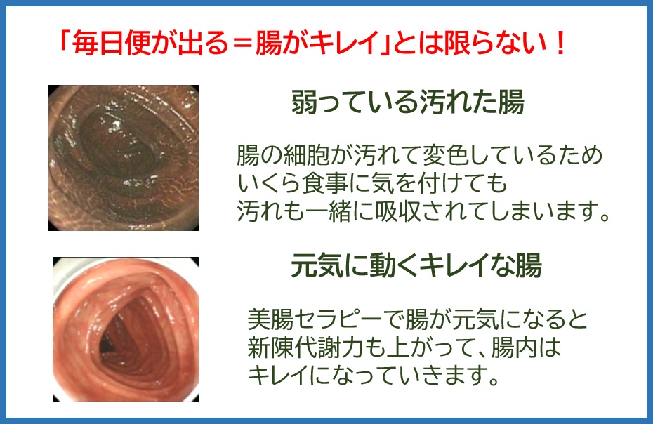 ■1DAYレッスン■正しい腸ケアで細胞から若返ろう 腸を元気にする講座【1/23】HP限定