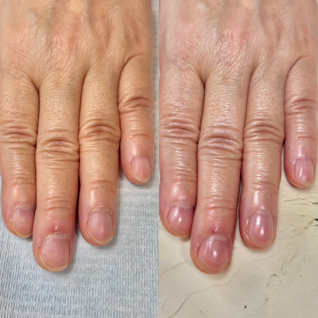 (全3回)手肌のお悩みを解消 ハンド&ネイル エイジングケア 春の新講座 4/10・5/8・6/12(金)