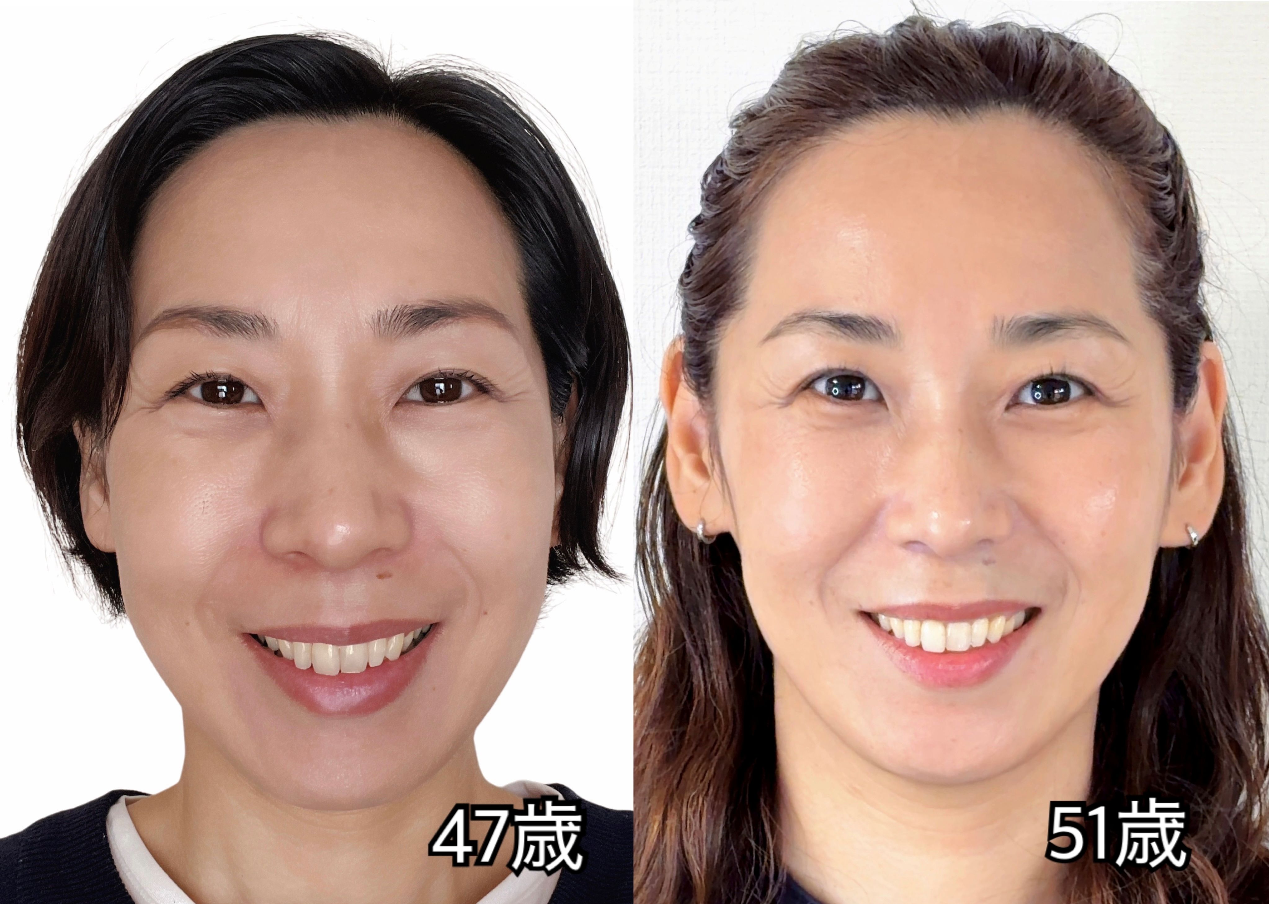 【秋の新講座】 表情筋を鍛えて若返り! 「笑顔が輝く顔ヨガ」 9/24スタート